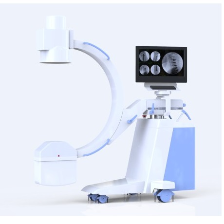 ALX-112D High frequency Digital Mobile C-arm System