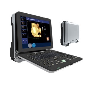 AU-P6 3D/4D COLOR DOPPLER ULTRASOUND
