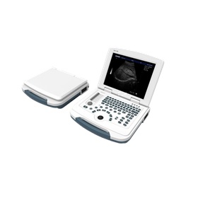 AU-580 Full-Digital Laptop Ultrasound machine